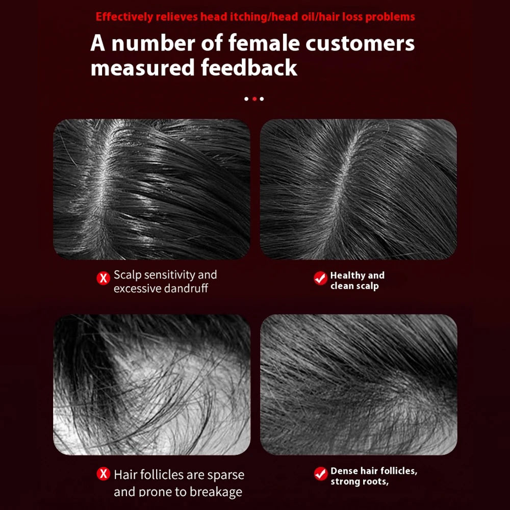 Peigne de Massage électrique, thérapie à la lumière rouge, Vibration, croissance des cheveux, brosse pour cuir chevelu, Anti-perte de cheveux, applicateur d'huile liquide